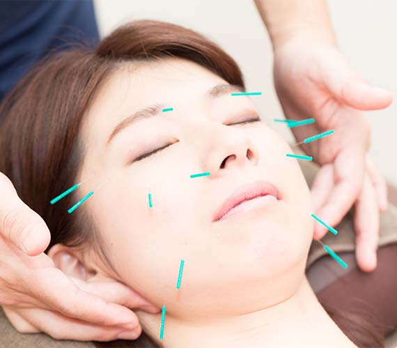 美容鍼（美容ケア）